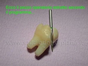 dente del giudizio incluso estratto